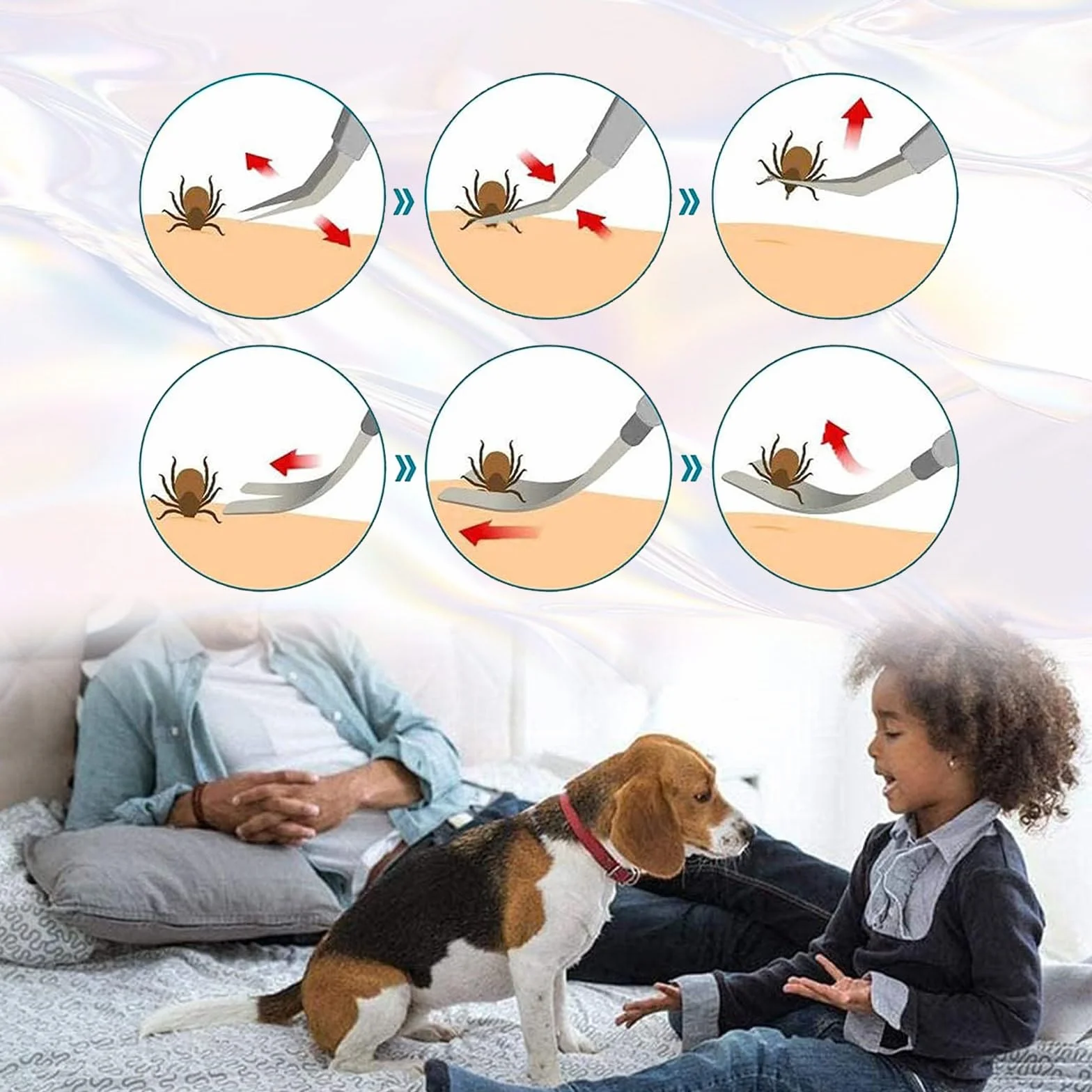 Crochet à Tique Professionnel en Acier Inoxydable - Lot de 3 Supprime Tiques