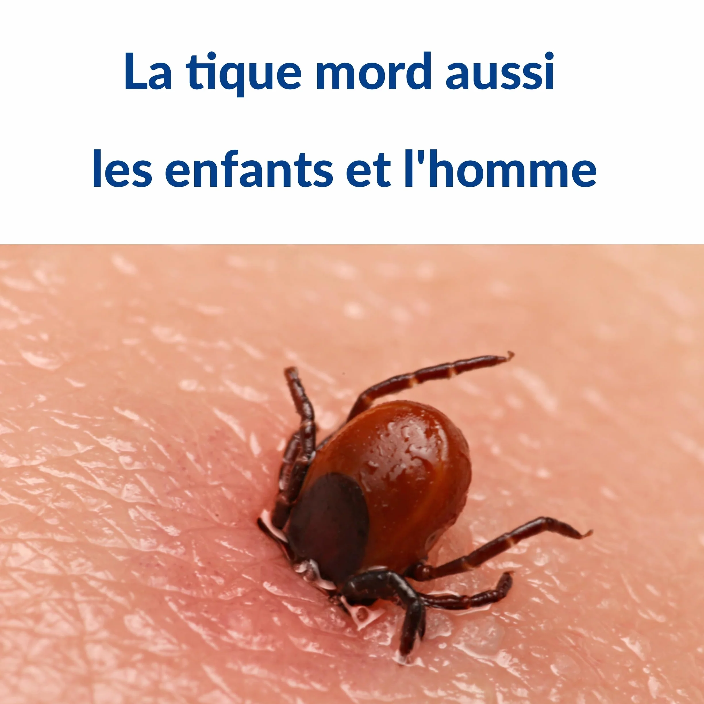 Tire Tique Pince à tique crochets anti tiques acier inoxydable pour chat chien humain Kit de 6 pièces