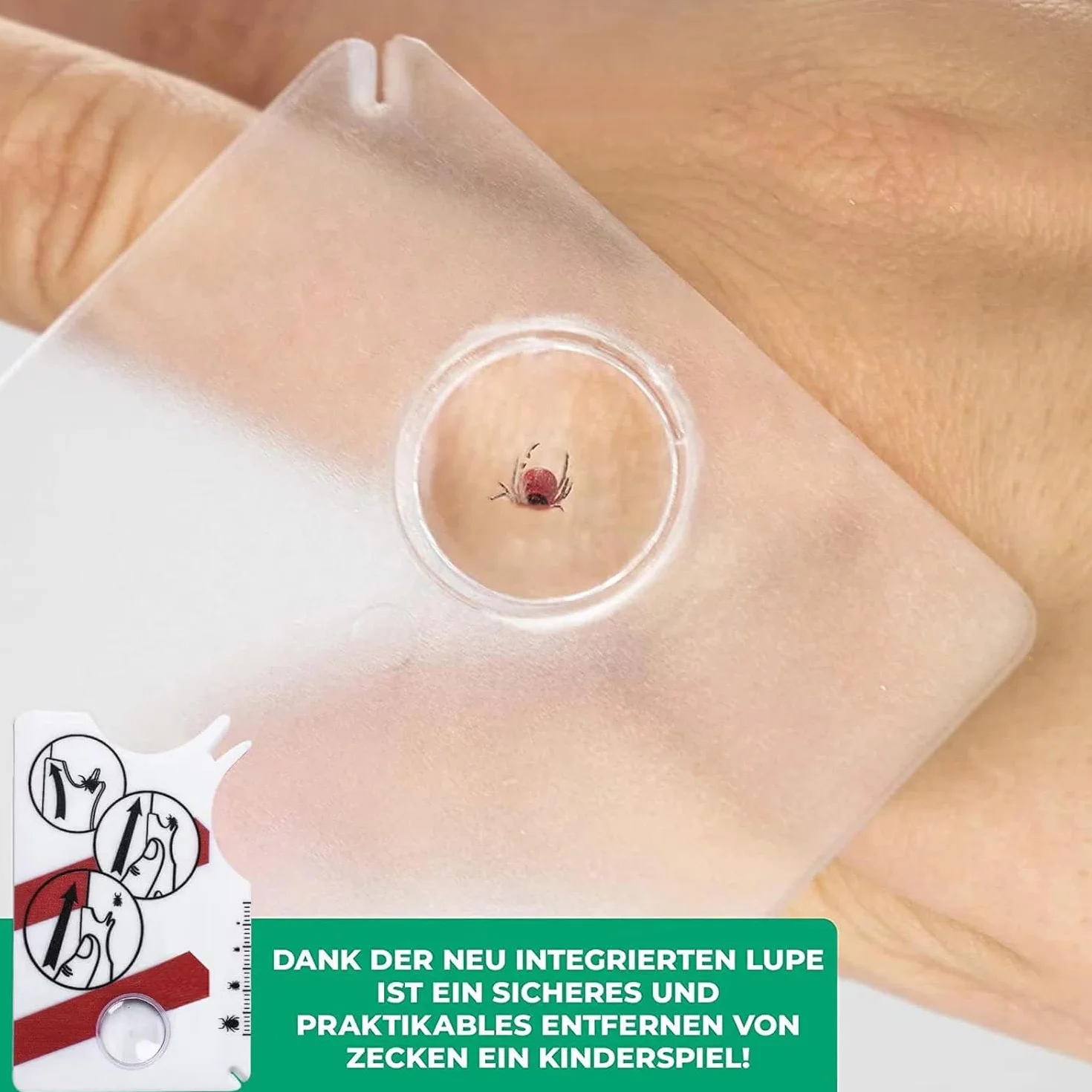 Lot de 2 cartes de retrait de tiques avec loupe, outil taille carte de crédit pour animaux et humains